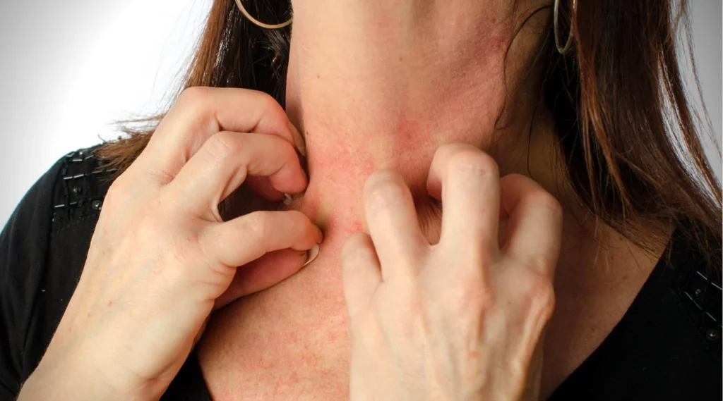 Which Metals are Common Irritants for People with Sensitive Skin?